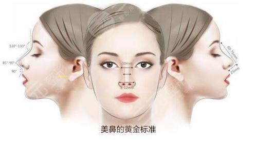 成都隆鼻贵吗(成都隆鼻子大概多少费用)