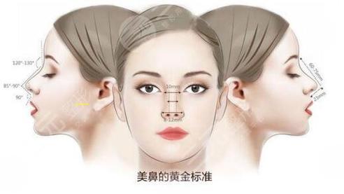 隆美脱钙骨隆鼻,隆鼻要多少钱我美不美吗